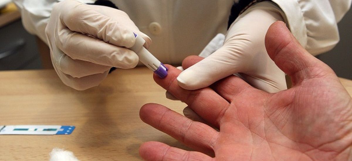 test hiv