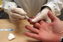 test hiv